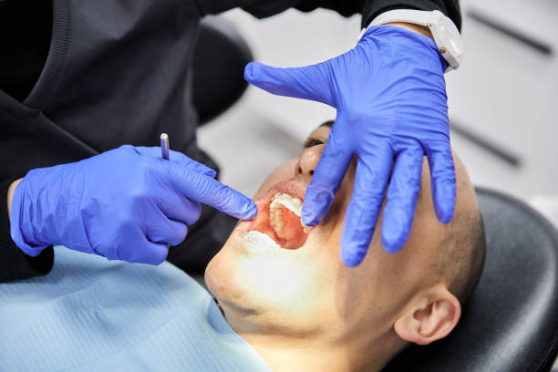 Best Emergency Dental Care for Broken or Chipped Teeth in Taft Southwest, TX