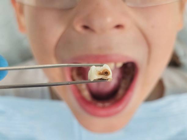 Best Urgent Care for Lost Fillings or Crowns in Taft Southwest, TX