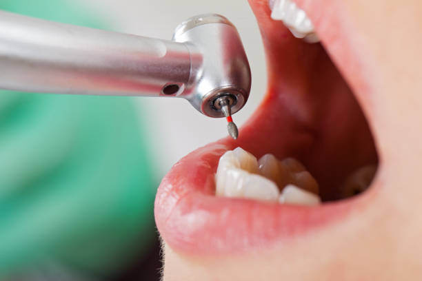 Best Emergency Root Canal Treatment in Taft Southwest, TX